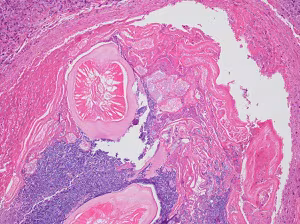 Case_511_B Figure B