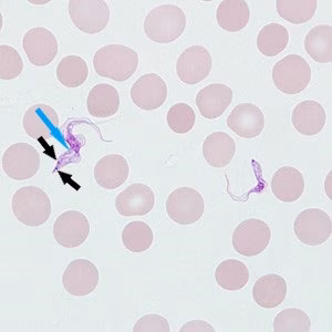 Case_514_answer