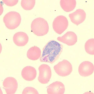 Case_515A Figure D