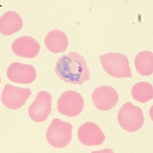 Case_515_E Figure E