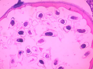 Case_516_C Figure C