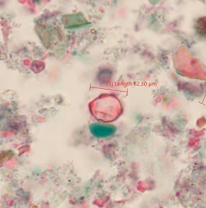 Case_520_C Figure B