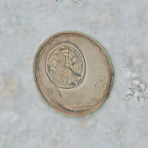 Case_519_B Figure B