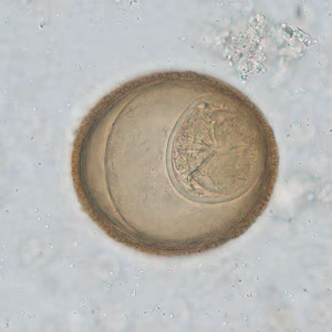 Case_521C Figure C