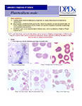 Preparation of Blood Smears