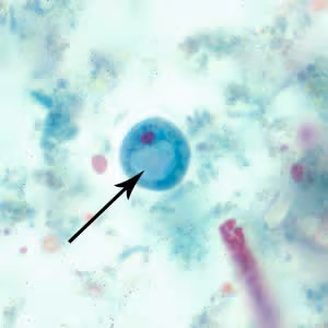 Figure C
