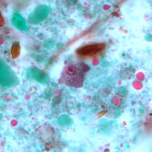 Figure B