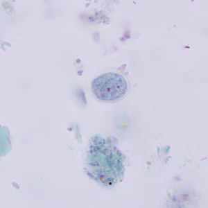 Figure D