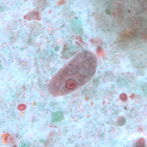 Figure D