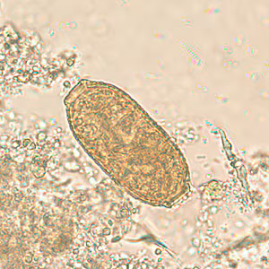 C_philippinensis_egg1.jpg Figure A