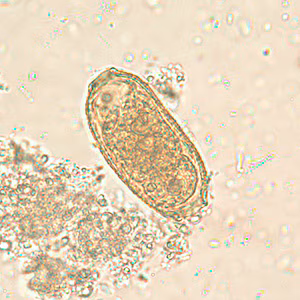 C_philippinensis_egg2.jpg Figure B