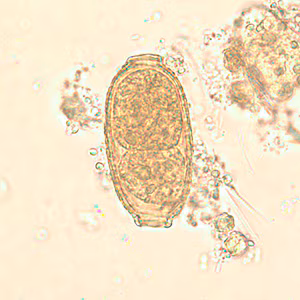 C_philippinensis_egg4.jpg Figure C