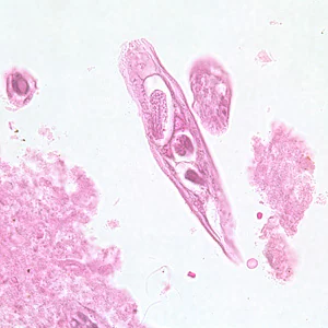 C_philippinensis_tissue5.jpg