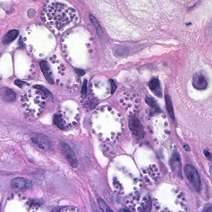 Leish_amasti_HnE_tissue_mn.jpg