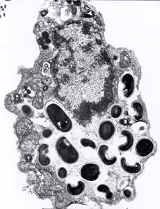 Eintestinalis_spores_EM_2012.jpg