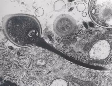 msp_tubule_EM2_2012.jpg