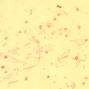Ebieneusi_spores_chromo2012.jpg