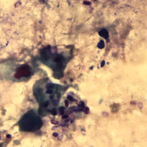 Ecuniculi_spores_gramchromo2_2012.jpg