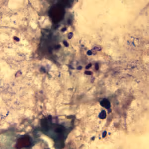 Ecuniculi_spores_gramchromo3_2012.jpg