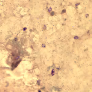 Ecuniculi_spores_gramchromo_2012.jpg