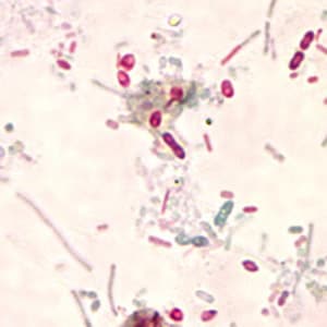 Microsporidia_2012.jpg