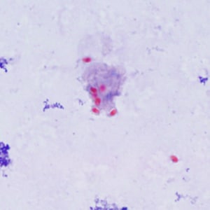 Ec_MAYO_Trichrome1.jpg