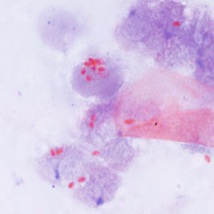 Ec_MAYO_Trichrome2.jpg
