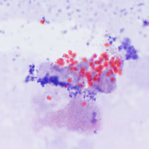 Ec_MAYO_Trichrome3.jpg