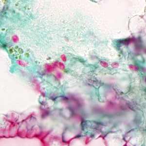 Tub_acrid_NIH_2012a.jpg