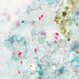 Tub_acrid_NIH_2012b.jpg