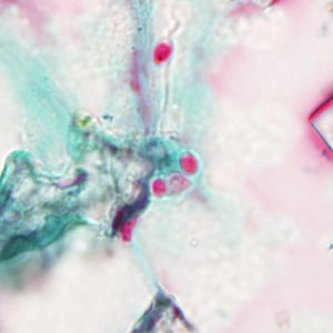 Tub_acrid_NIH_2012c.jpg