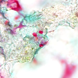 Tub_acrid_NIH_2012d.jpg