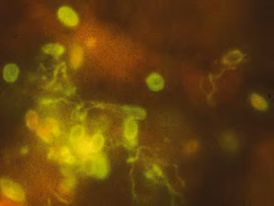 Ehellem_spores_IFA_2012.jpg