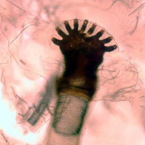 C_hominovorax_anterior_spiracleB.jpg Figure D