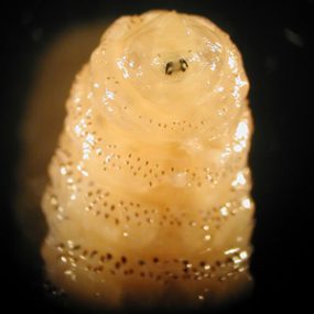 D_hominis_anterior_A.jpg Figure B