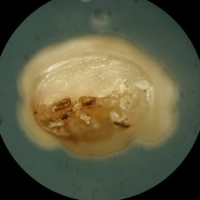 Cuterebra_posterior_A.jpg Figure B