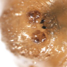 C_anthropophaga_mandibles.jpg Figure C