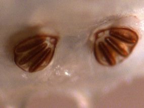 Phaenicia_postspiracles_WA2.jpg Figure D