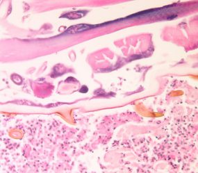Cordylobia_tissue_BAM1.jpg Figure E