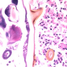 Cordylobia_tissue_BAM2.jpg Figure F