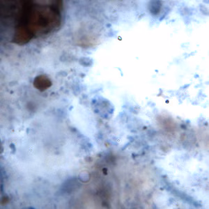 E_hominis_cyst_BAM2.jpg Figure A