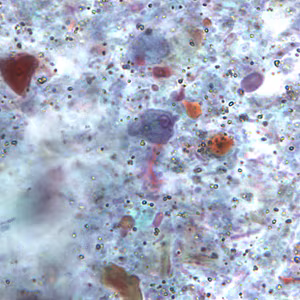R_intestinalis_troph_BAM2.jpg Figure B