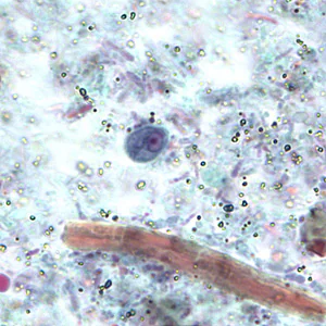 R_intestinalis_cyst_BAM2.jpg Figure A