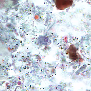 R_intestinalis_cyst_BAM3.jpg Figure B