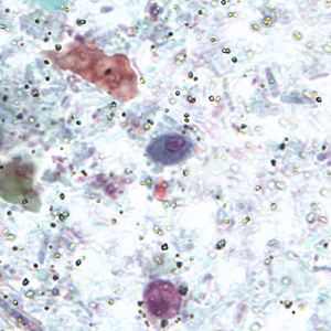 R_intestinalis_cyst_BAM4.jpg Figure C