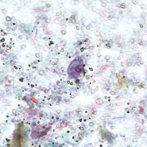 R_intestinalis_cyst_BAM5.jpg Figure D
