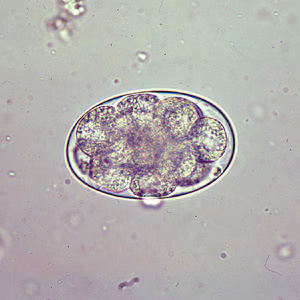 Oesophagostomum_egg_A.jpg