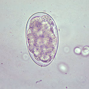 Oesophagostomum_egg_B.jpg