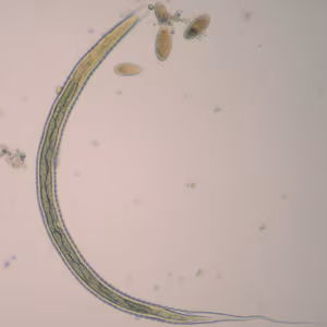 Oesophagostomum_L3_ZAF1.jpg