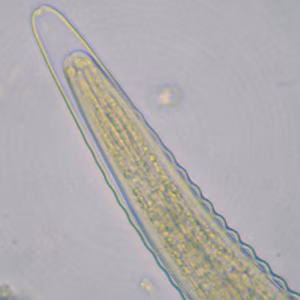 Oesophagostomum_L3_ZAF2.jpg